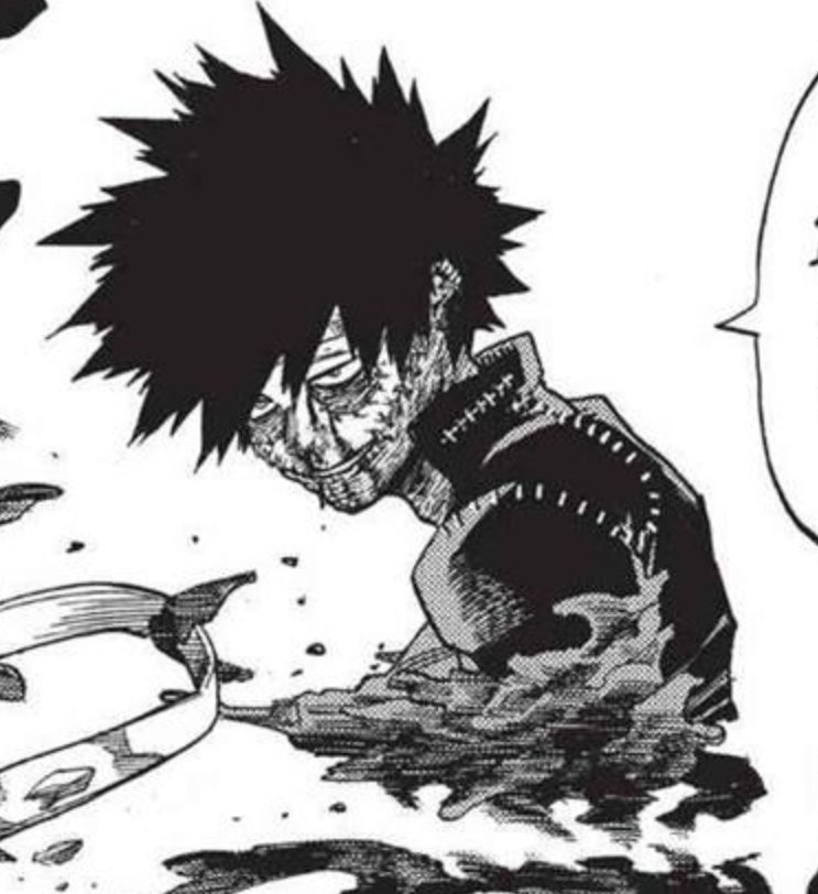 Featured image of post Dabi Lazy Eye